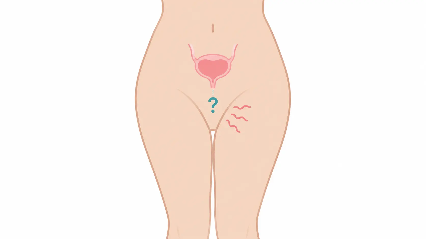 Outline of the pelvis showing the bladder inside and an itchy area outside, illustrating that a UTI usually doesn't cause itching